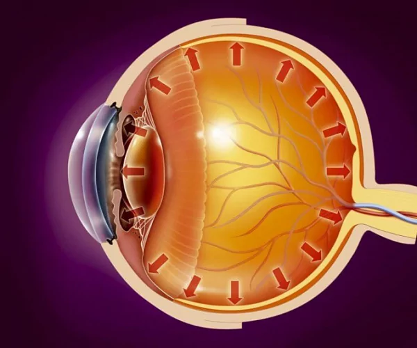 Глаукома: актуальные вопросы диагностики и лечения